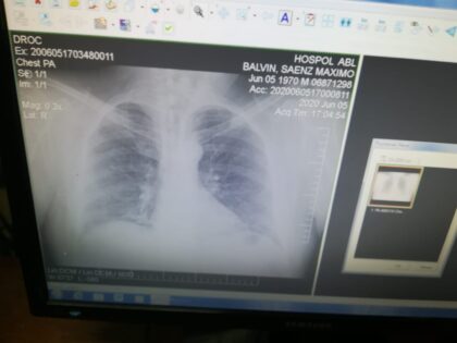 IMA PLACA GALLO